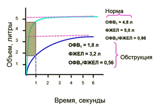 ris3
