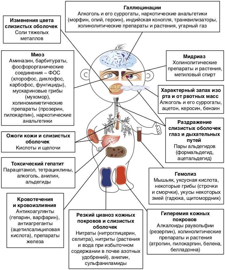 Детские болезни