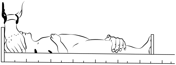 ris1 1