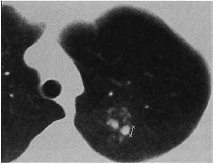 ris10 13