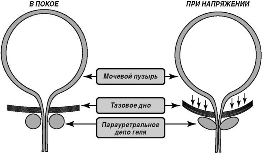 Фильтрационное давление схема. Эффективное фильтрационное давление схема. Фильтрационное давление в клубочке. Эффективное фильтрационное давление формула.