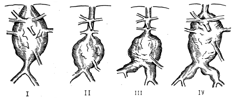 ris3