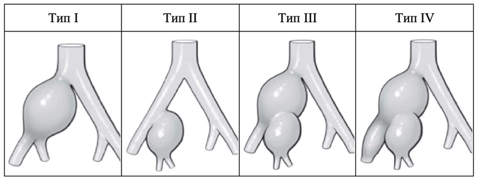 ris4