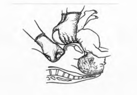 image11