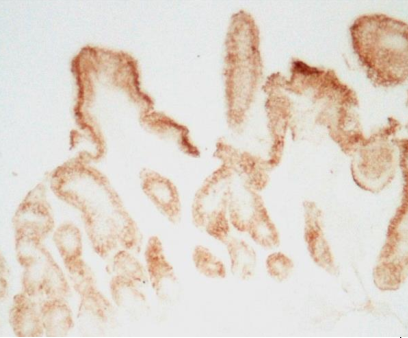 ris14