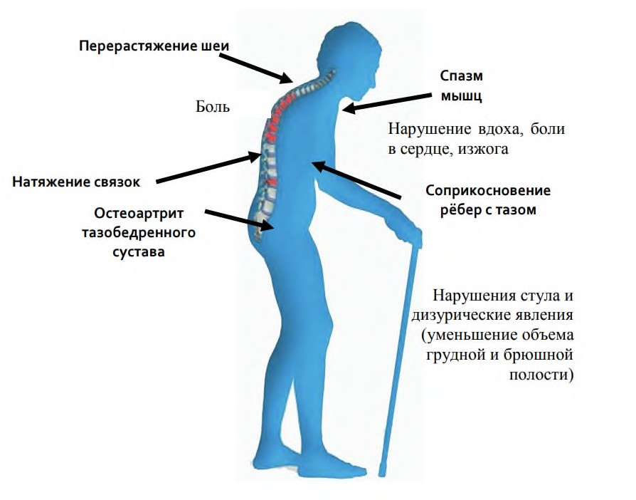 Картина боль или спазм