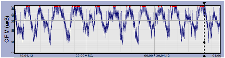 ris1g