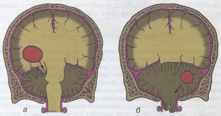 72