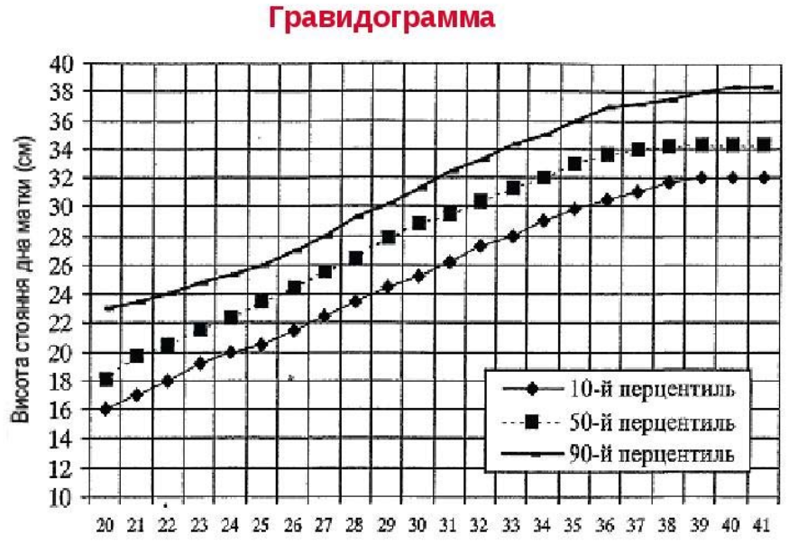pril g2