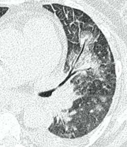 image22