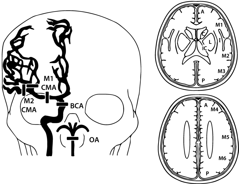 Сма мозга. Aspect ишемический инсульт кт. Шкала аспектс для оценки инсульта. Среднемозговая артерия сегменты. М1 сегмент средней мозговой артерии схема.