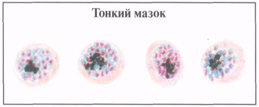 image22