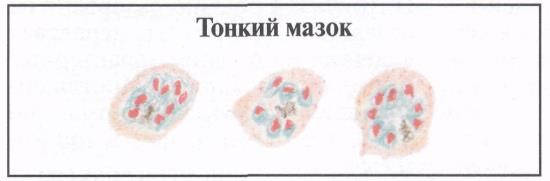 image32