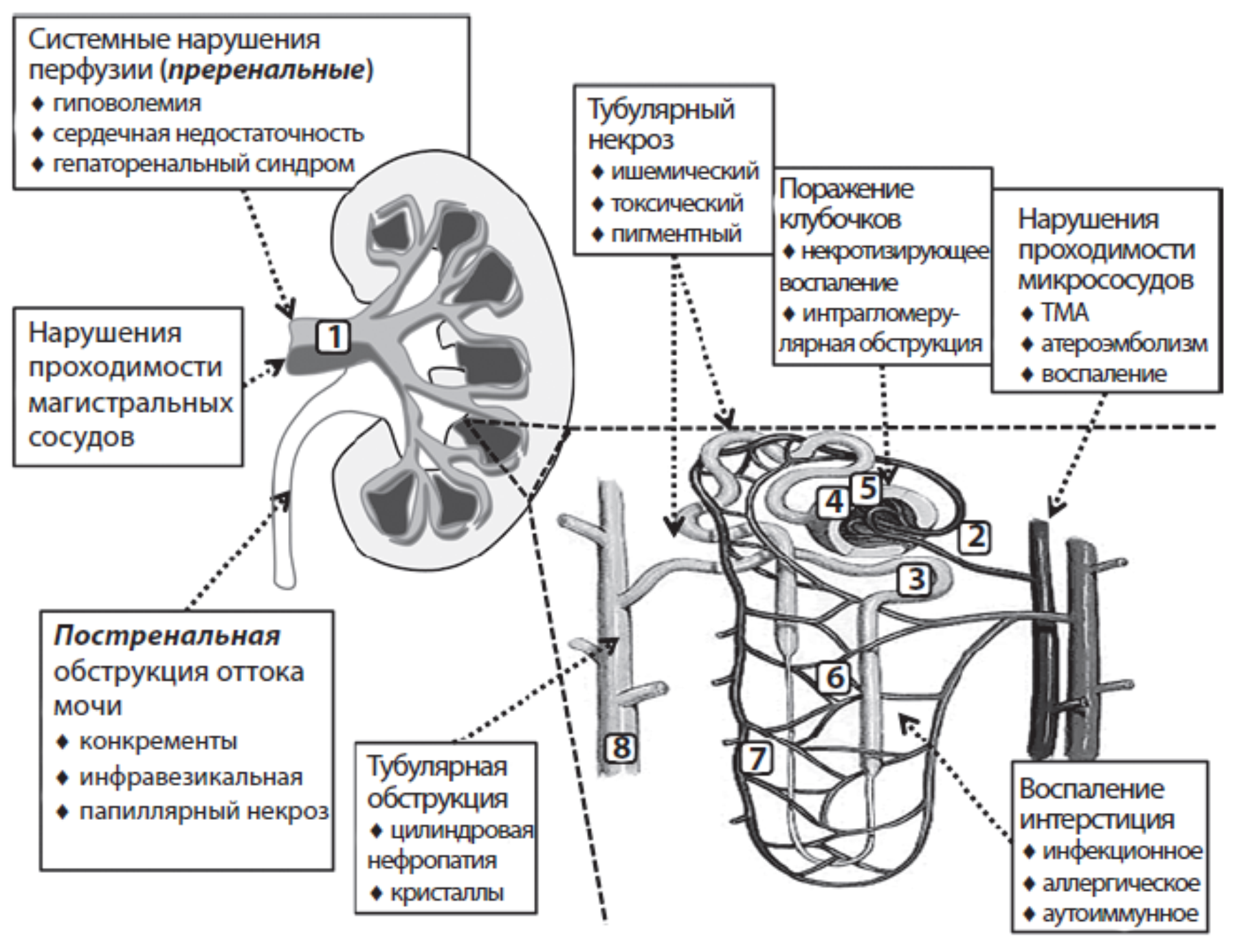 ris-2