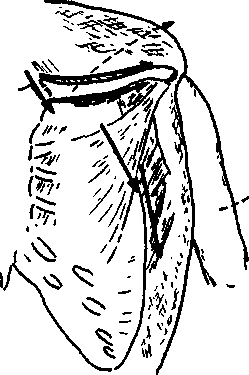 image101