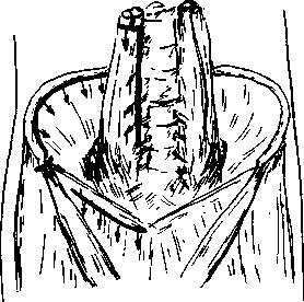 image111