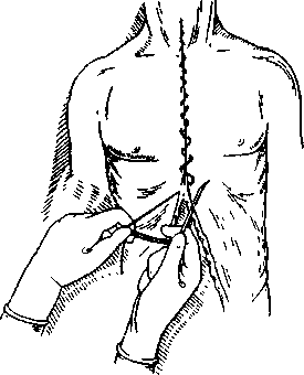 image113