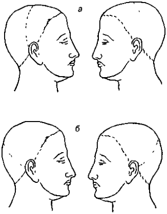 image44