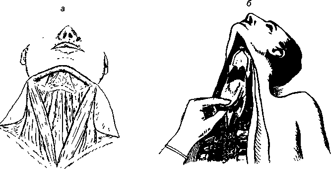 image78