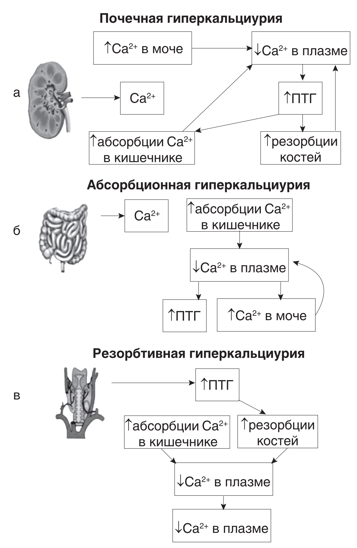 Синдром раздраженного кишечника