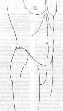 image13